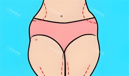 趙軍艦腹部吸脂價格表:12800元起步,正規(guī)操作技術(shù)好,吸脂部位價格不貴,性價比高推薦!